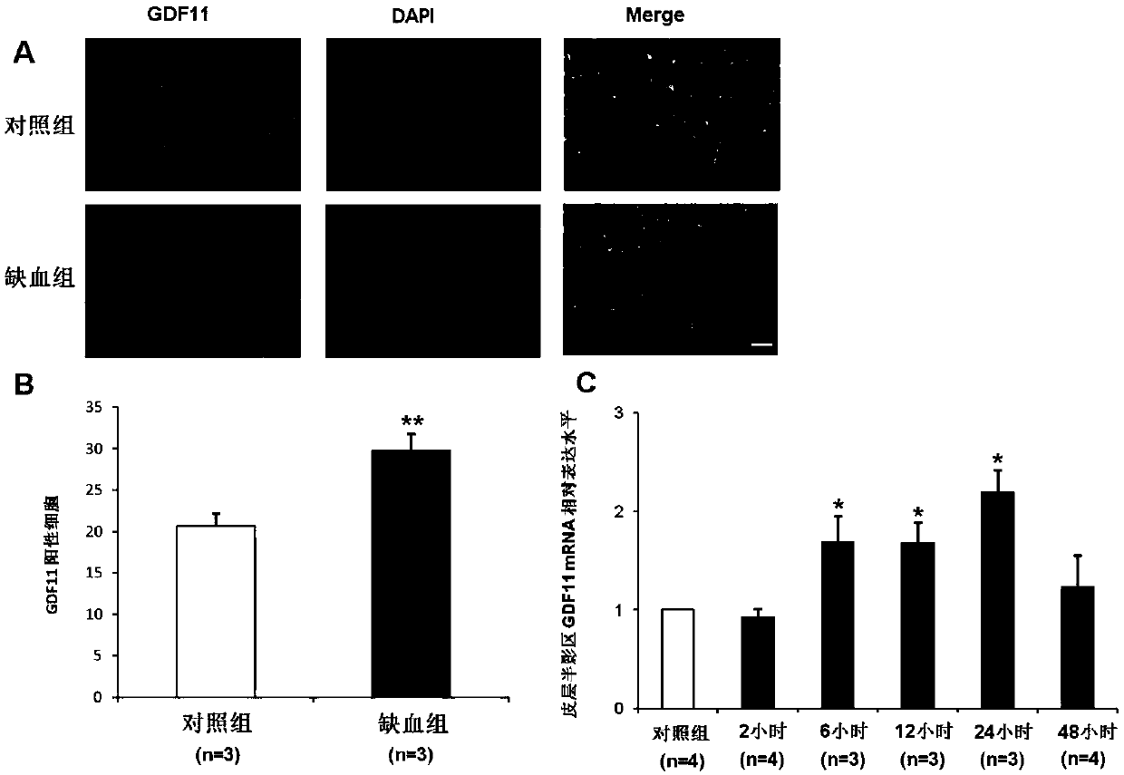 Application of growth differentiation factor 11 in preparation of medicine for treating ischemic stroke