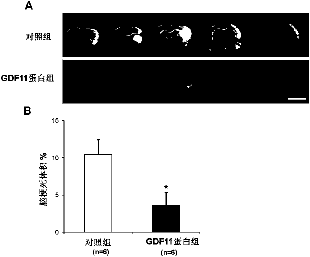 Application of growth differentiation factor 11 in preparation of medicine for treating ischemic stroke