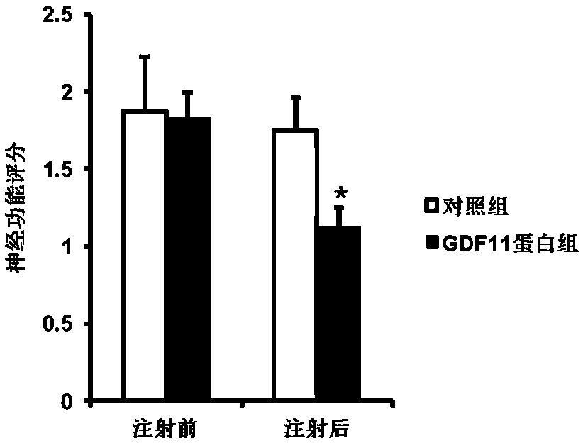 Application of growth differentiation factor 11 in preparation of medicine for treating ischemic stroke