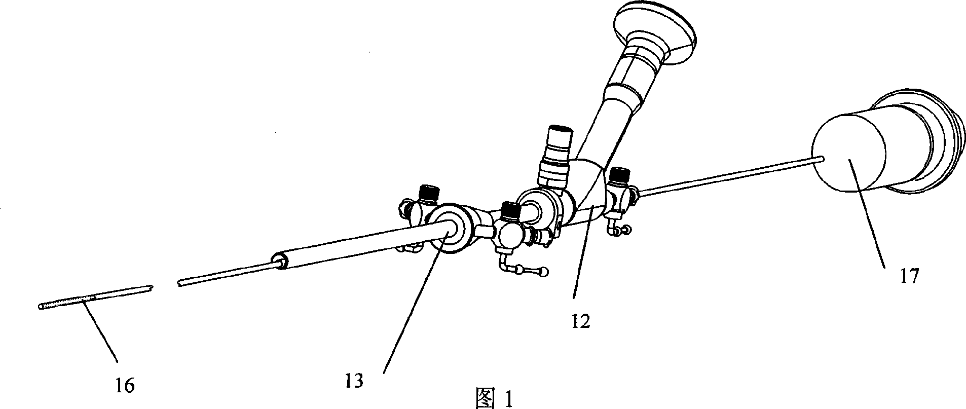 Ultrasound hysteroscope system