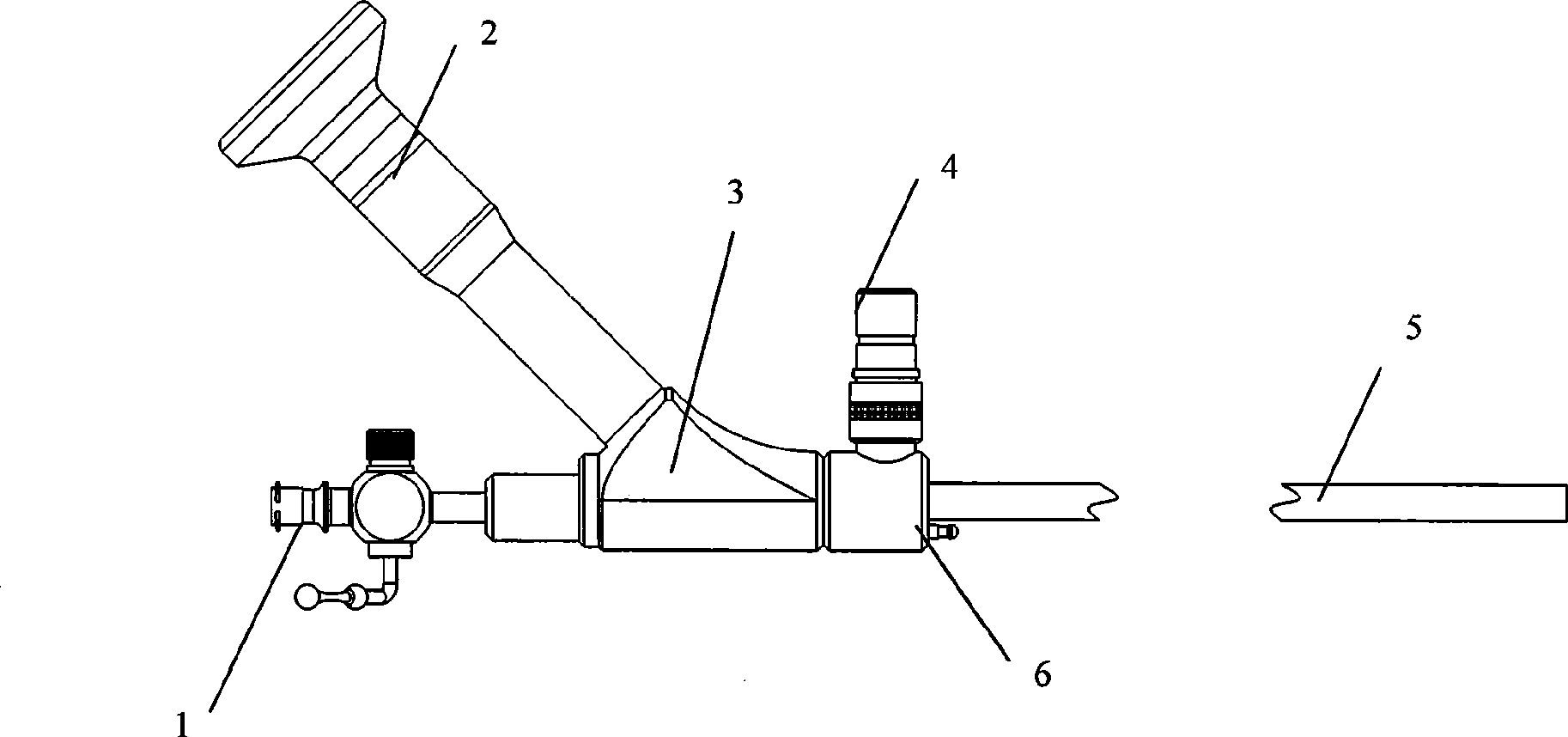 Ultrasound hysteroscope system