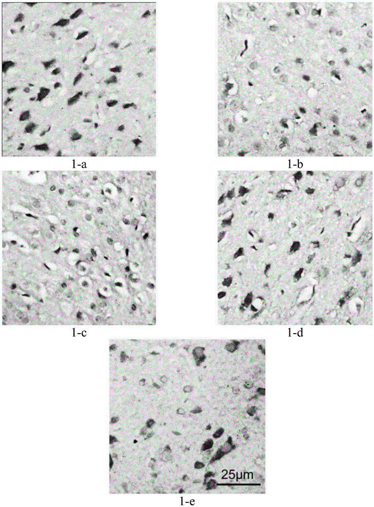 A kind of pharmaceutical composition and its application