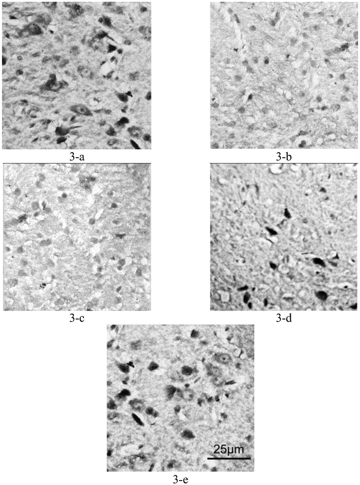 A kind of pharmaceutical composition and its application