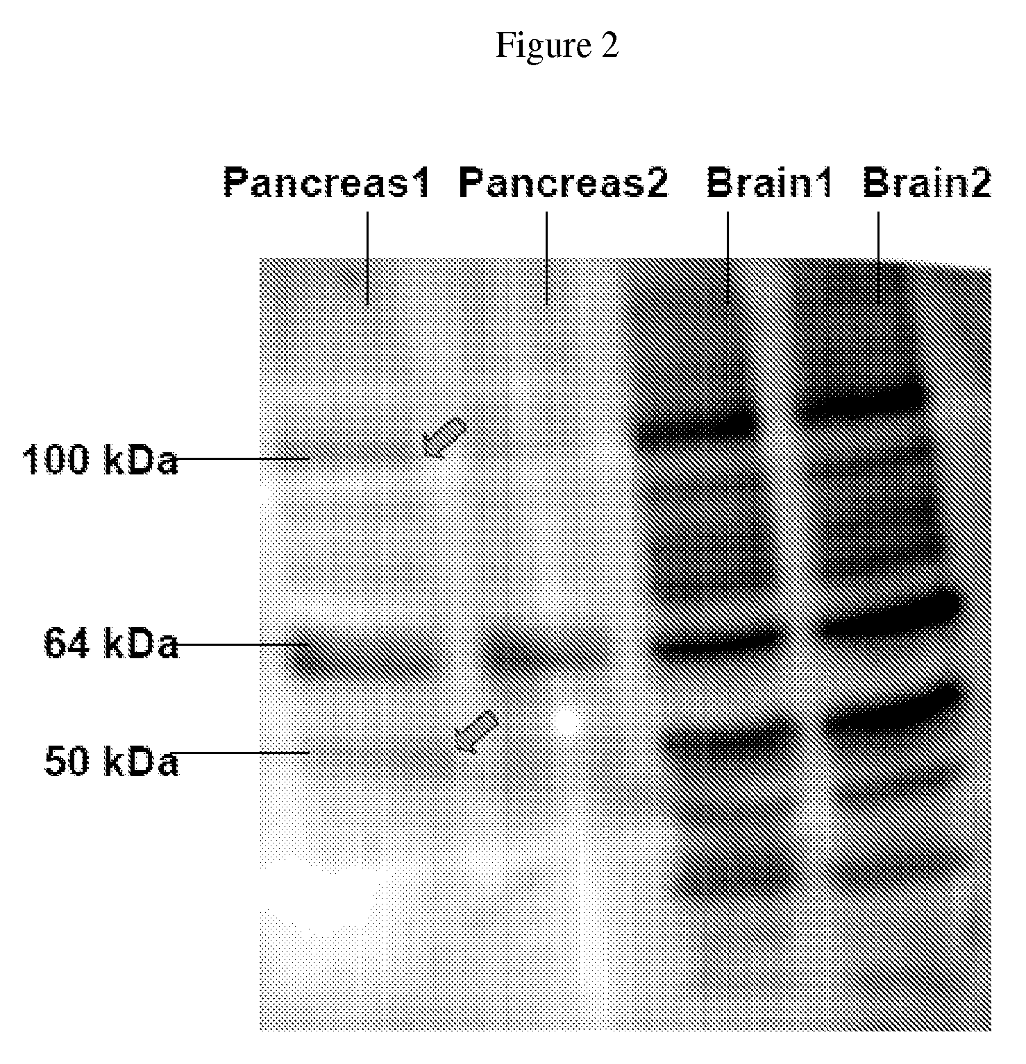 Methods and compositions for preventing and/or treating pancreatitis