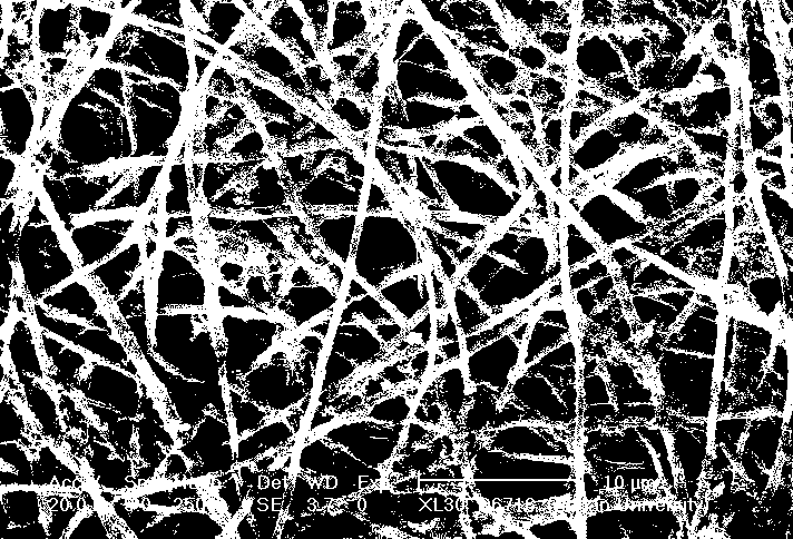 Preparation method of block polymer immobilized enzyme