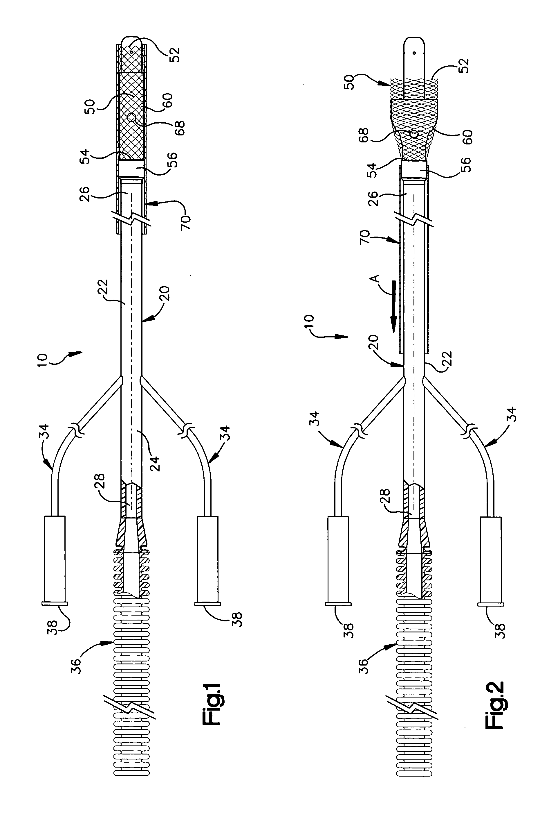 Apparatus and method for auto-retroperfusion of a coronary vein