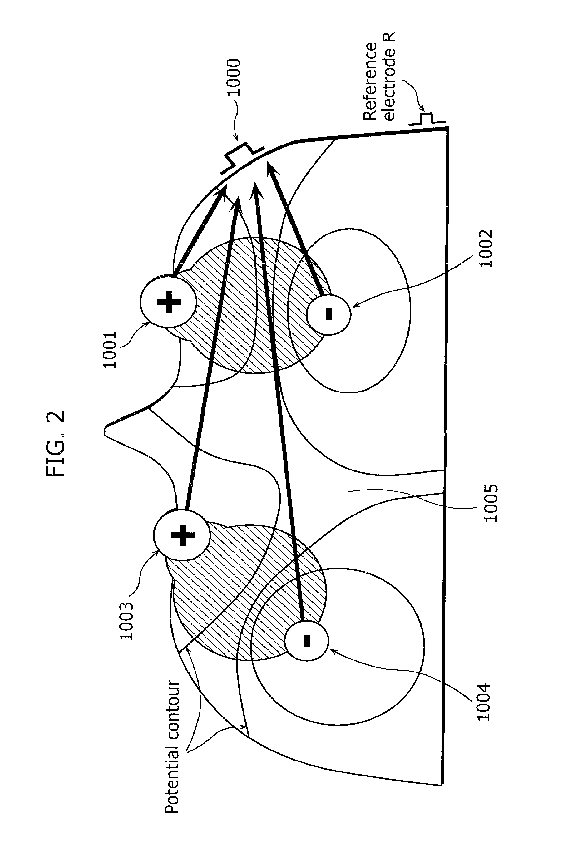 Eye-gaze tracking device, eye-gaze tracking method, electro-oculography measuring device, wearable camera, head-mounted display, electronic eyeglasses, and ophthalmological diagnosis device