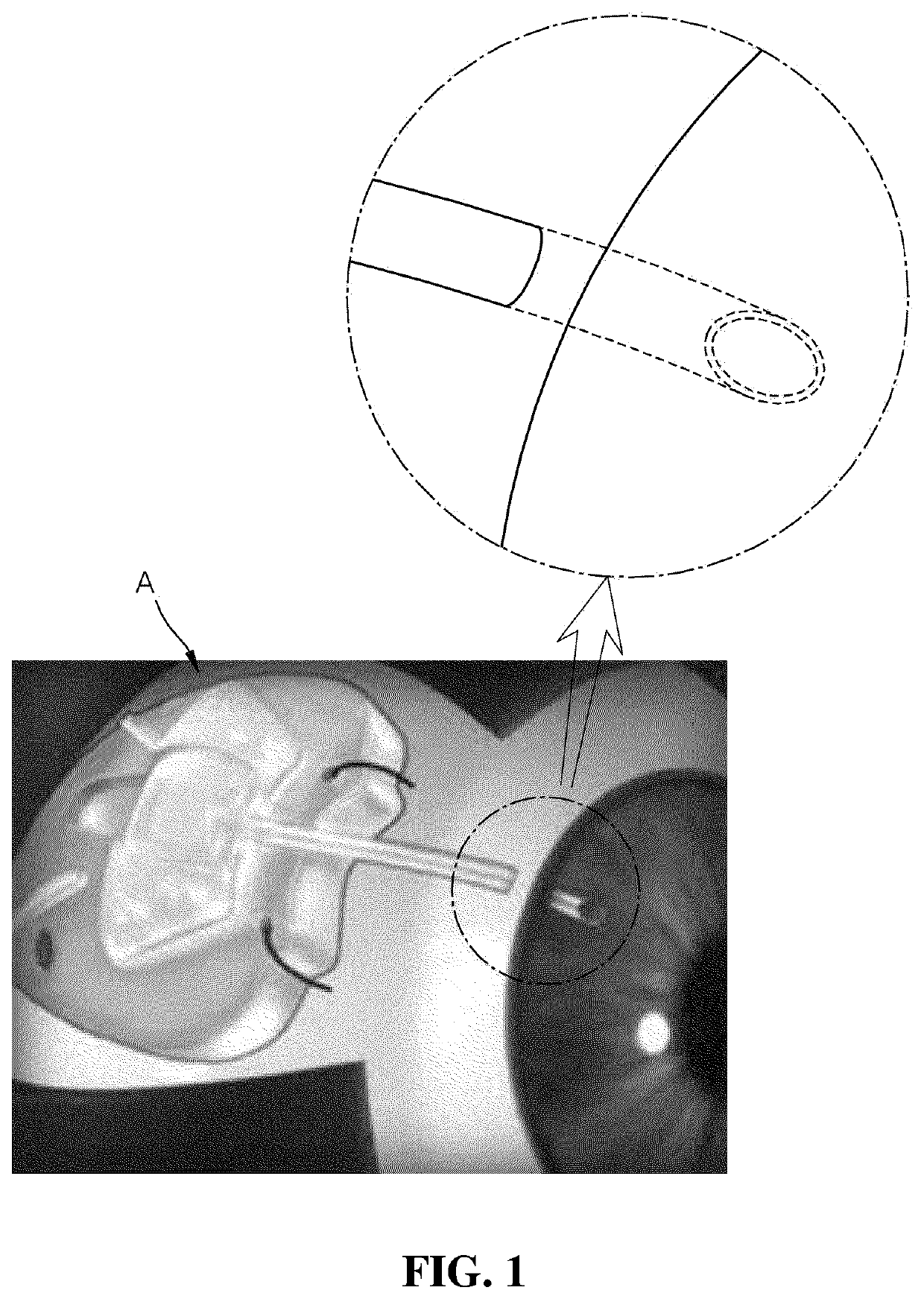 Aqueous humour discharge apparatus for glaucoma prevention