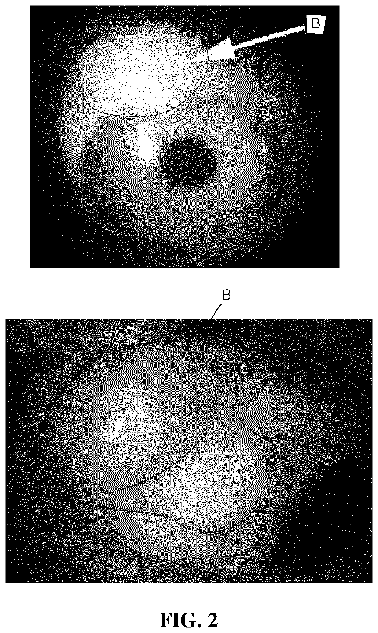 Aqueous humour discharge apparatus for glaucoma prevention