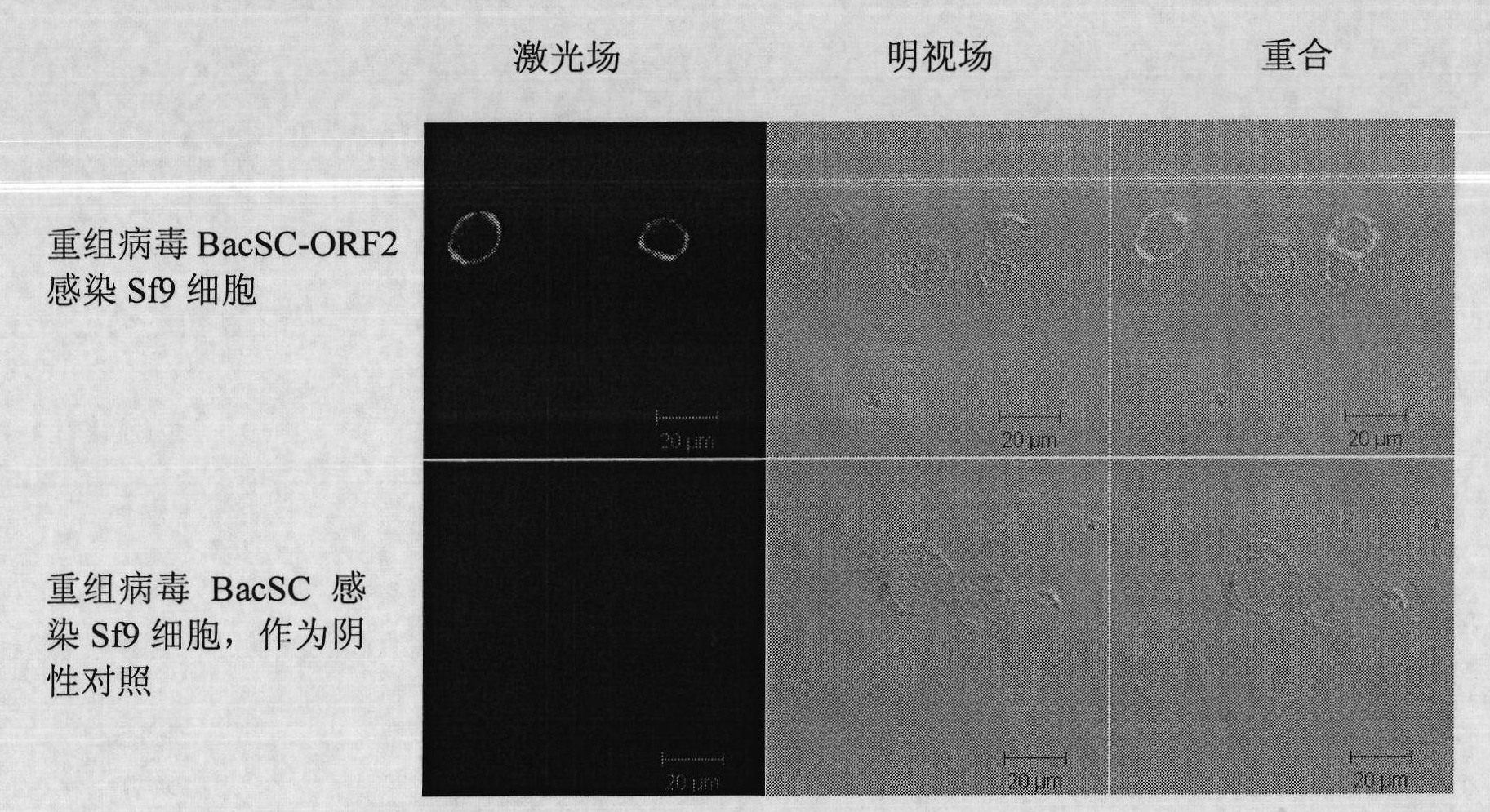 Recombinant baculovirus expressing porcine circovirus type 2 (PCV-2) immunogen gene and preparation method and application thereof