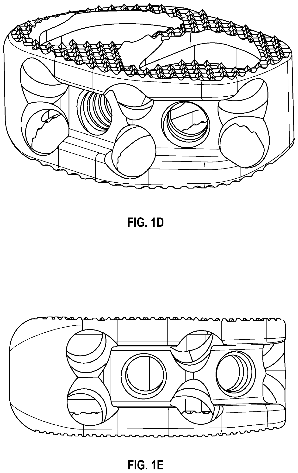 Interbody cage device and methods of use