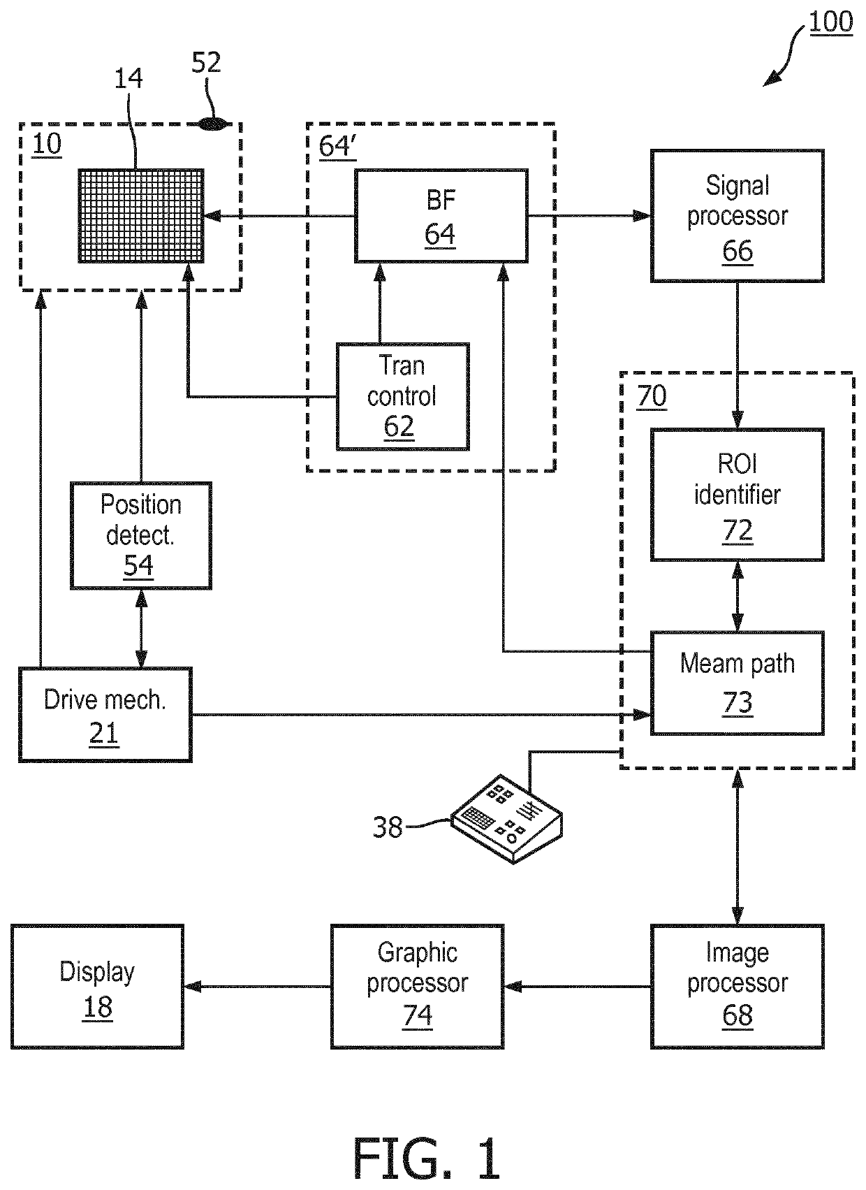 An ultrasound system with a tissue type analyzer