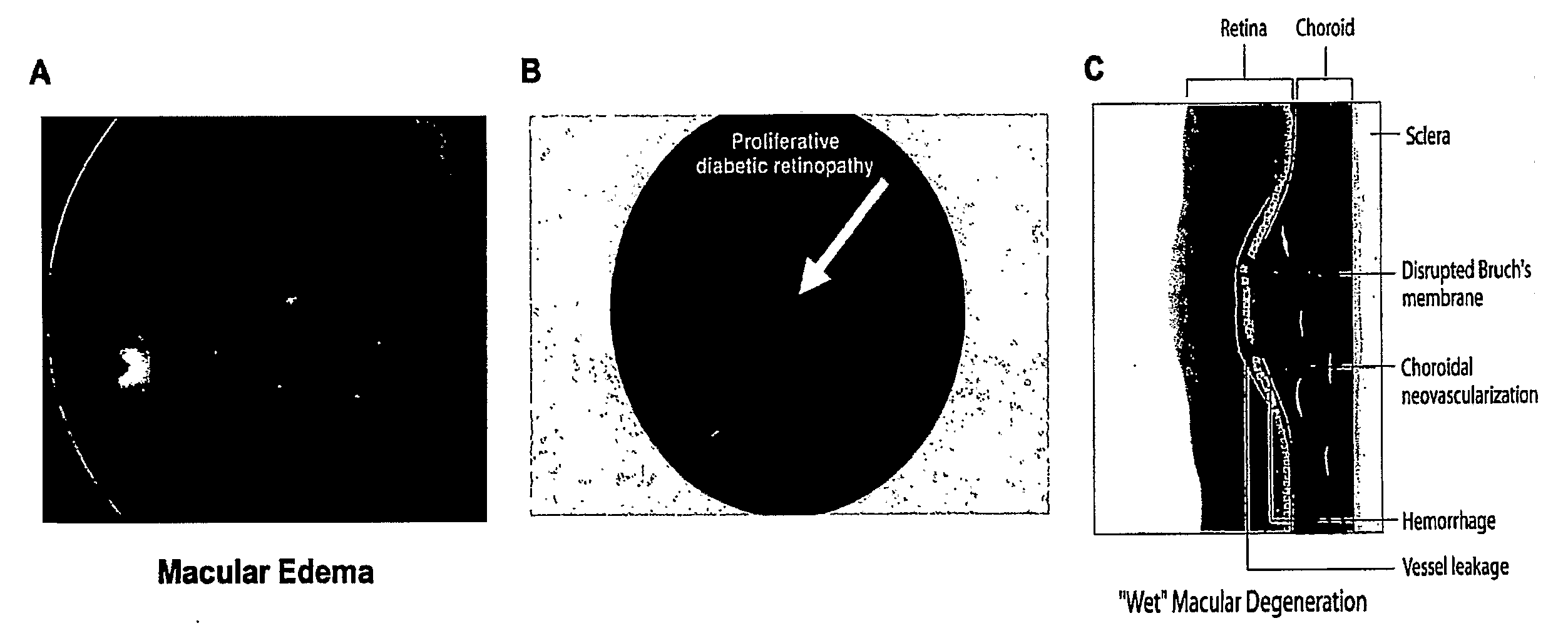 Tetracyclines for Treating Ocular Diseases and Disorders