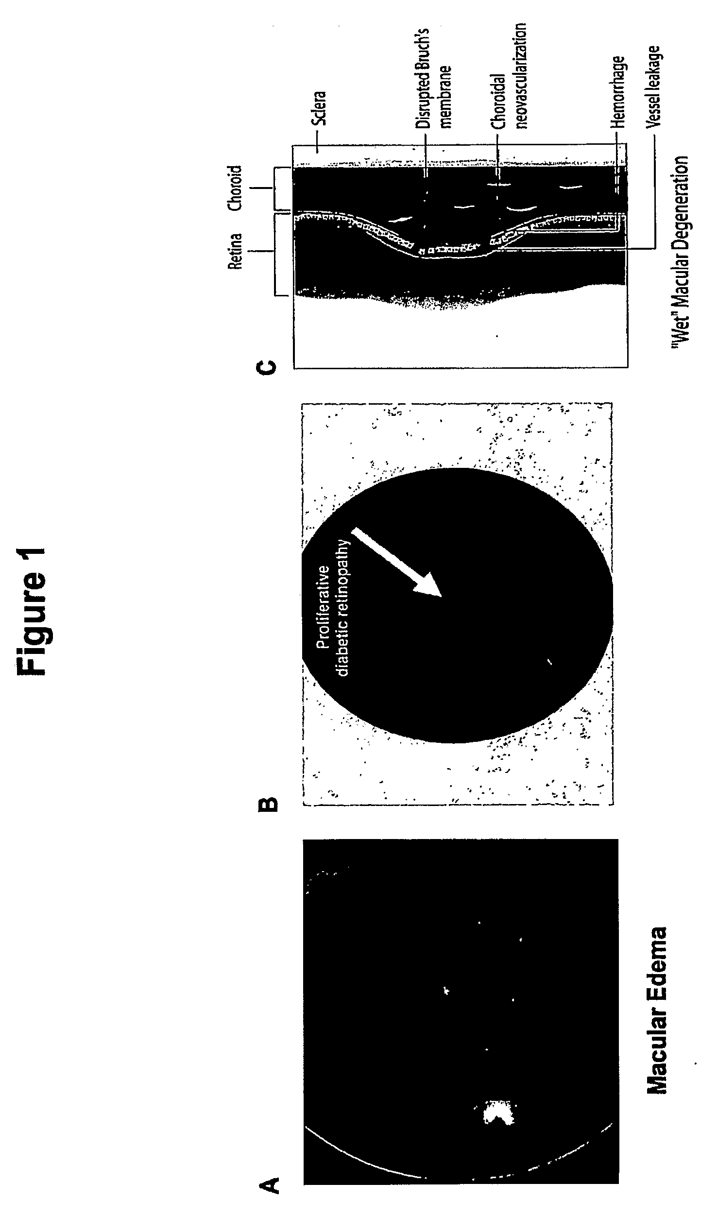 Tetracyclines for Treating Ocular Diseases and Disorders