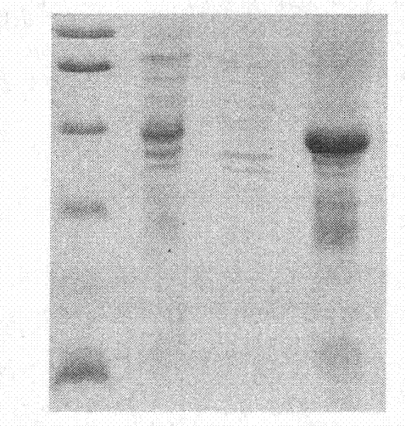 Enterovirus 71 capsid protein 1 antigen, preparation method and immunodetection reagent