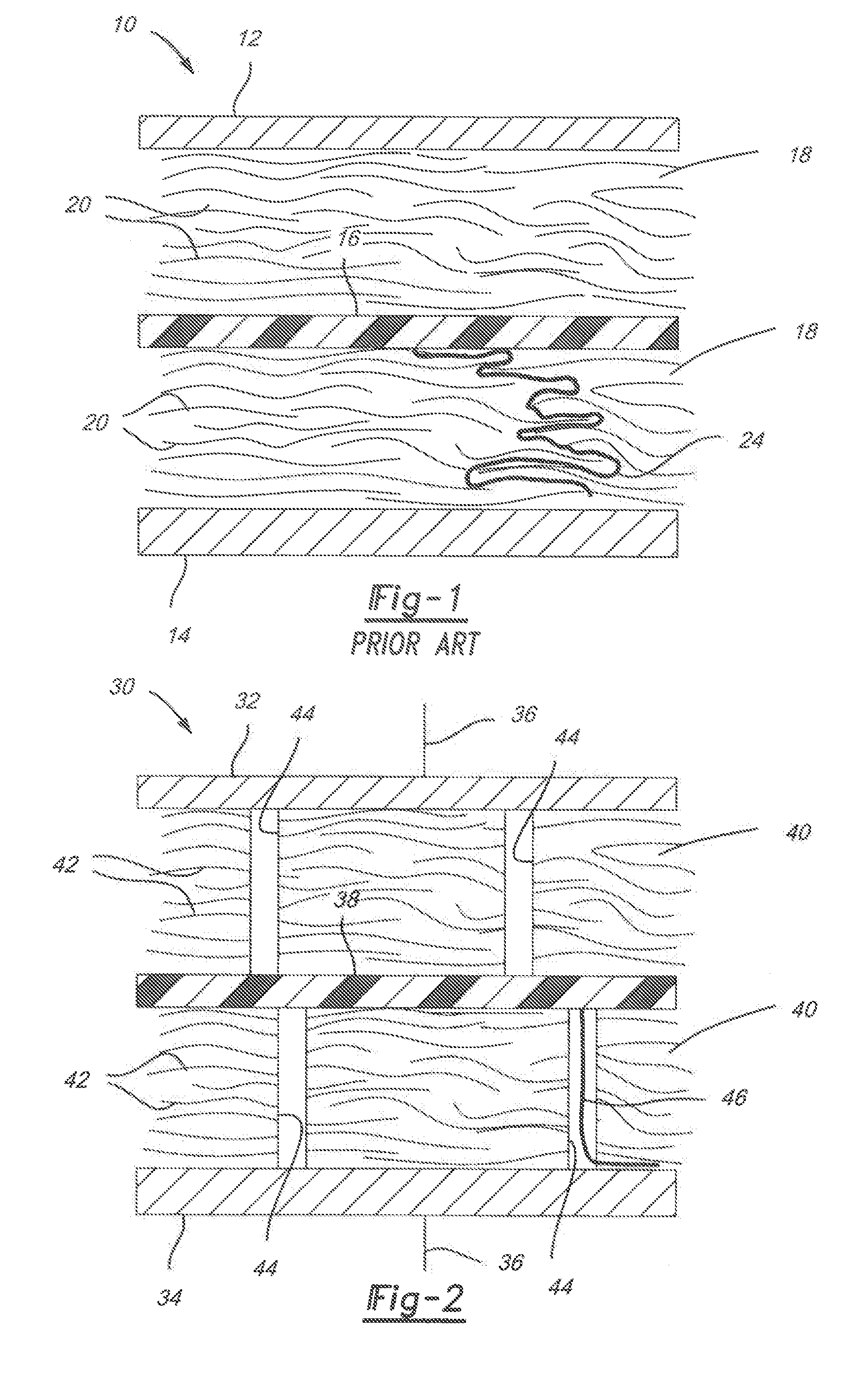 Supercapacitor