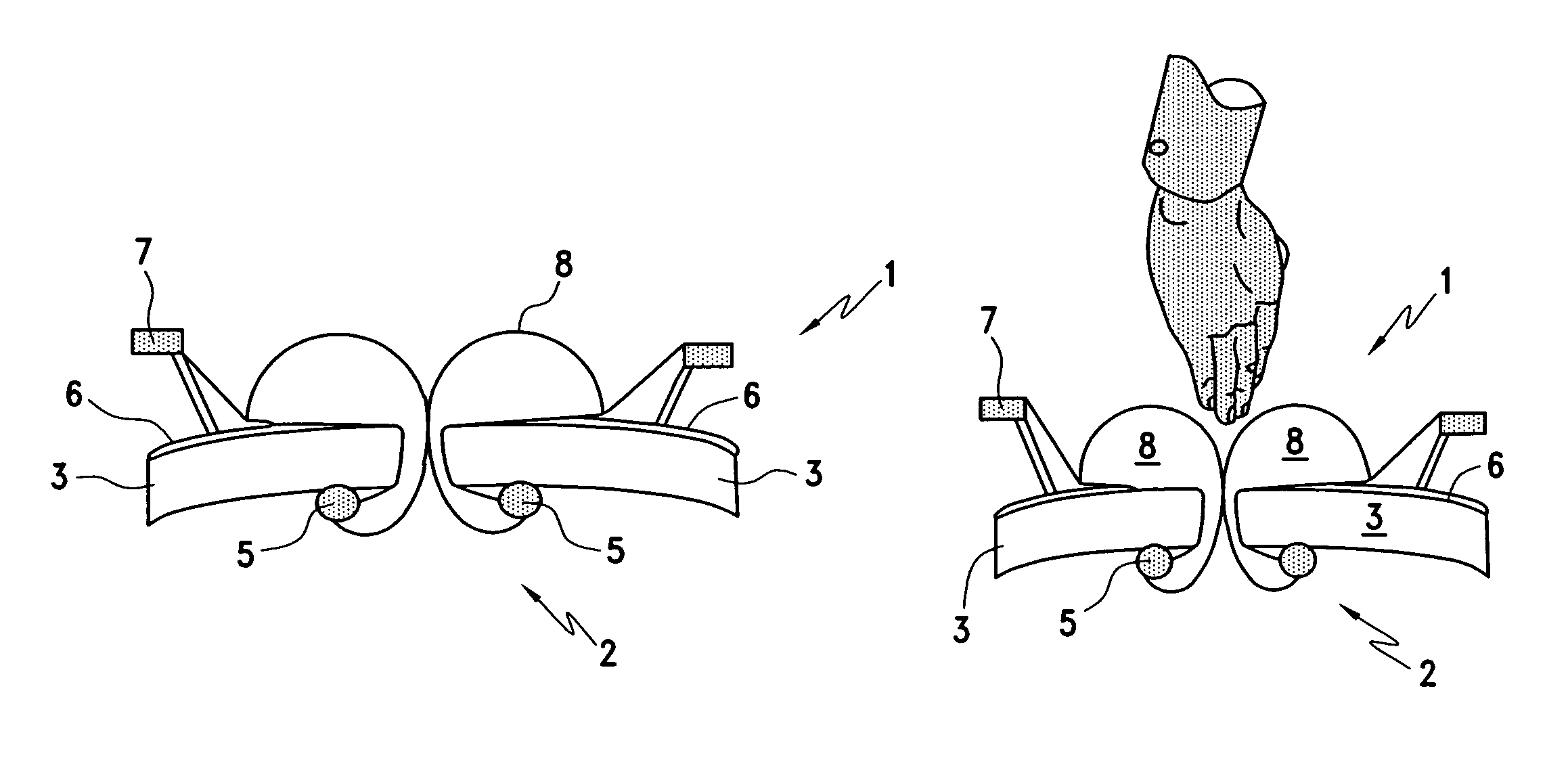 Surgical access device