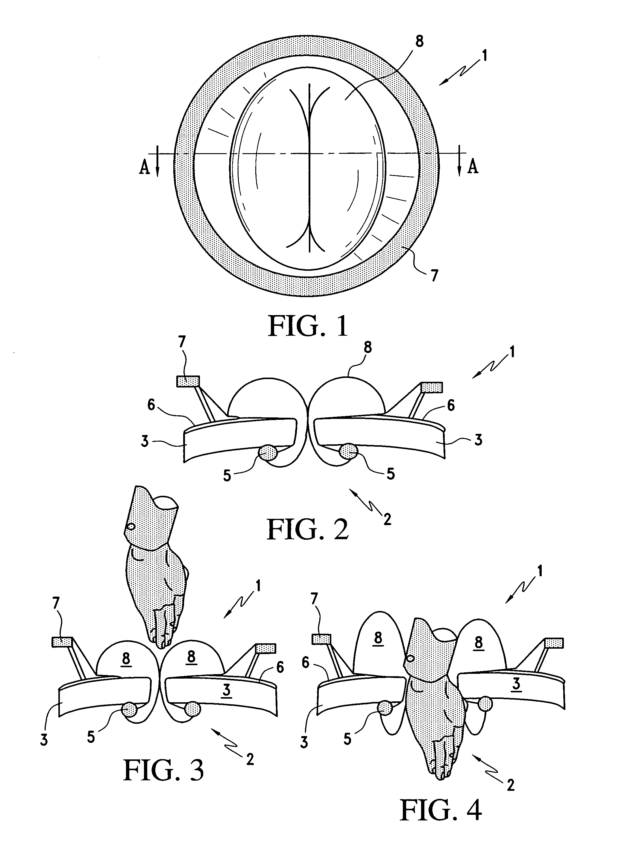 Surgical access device