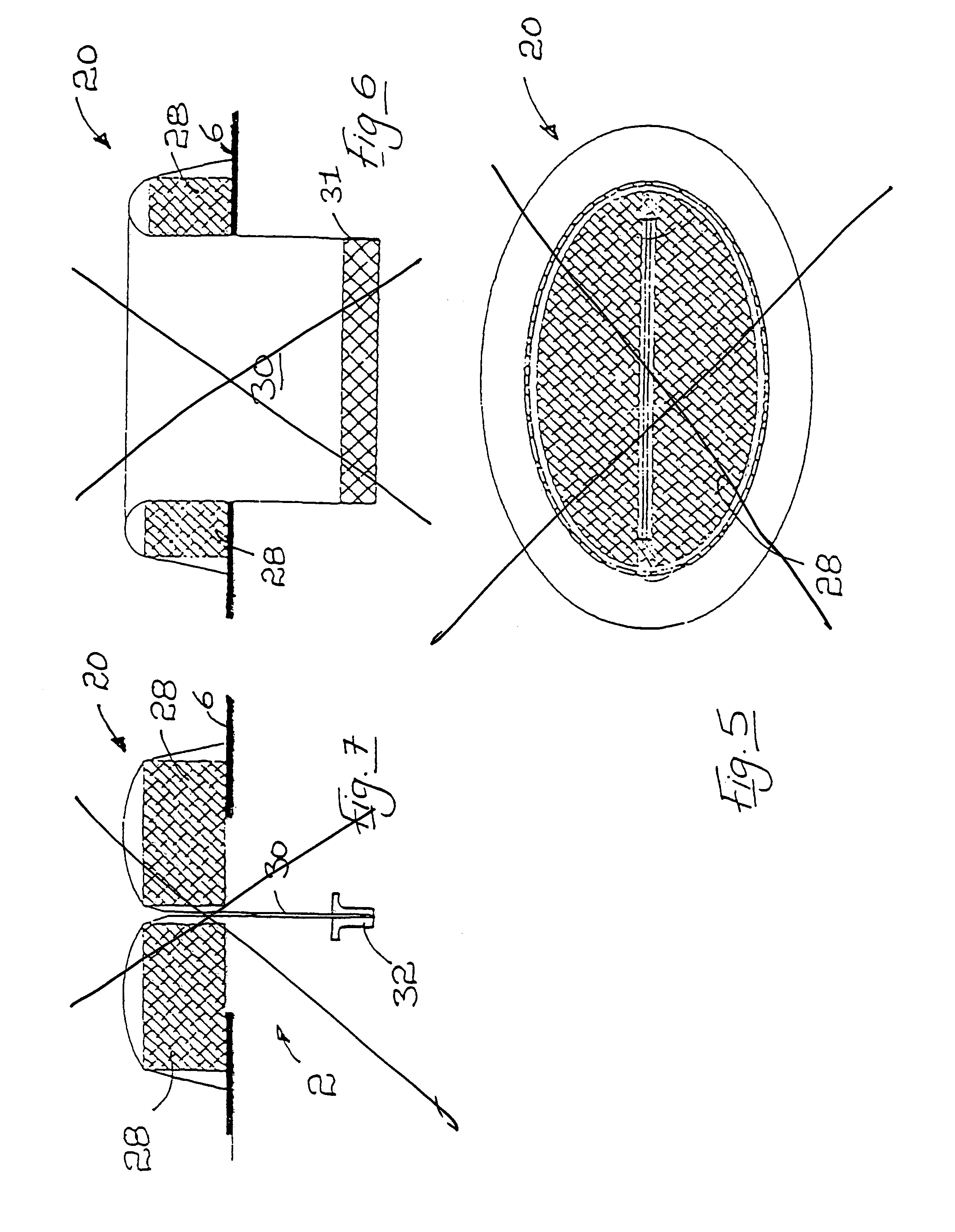 Surgical access device