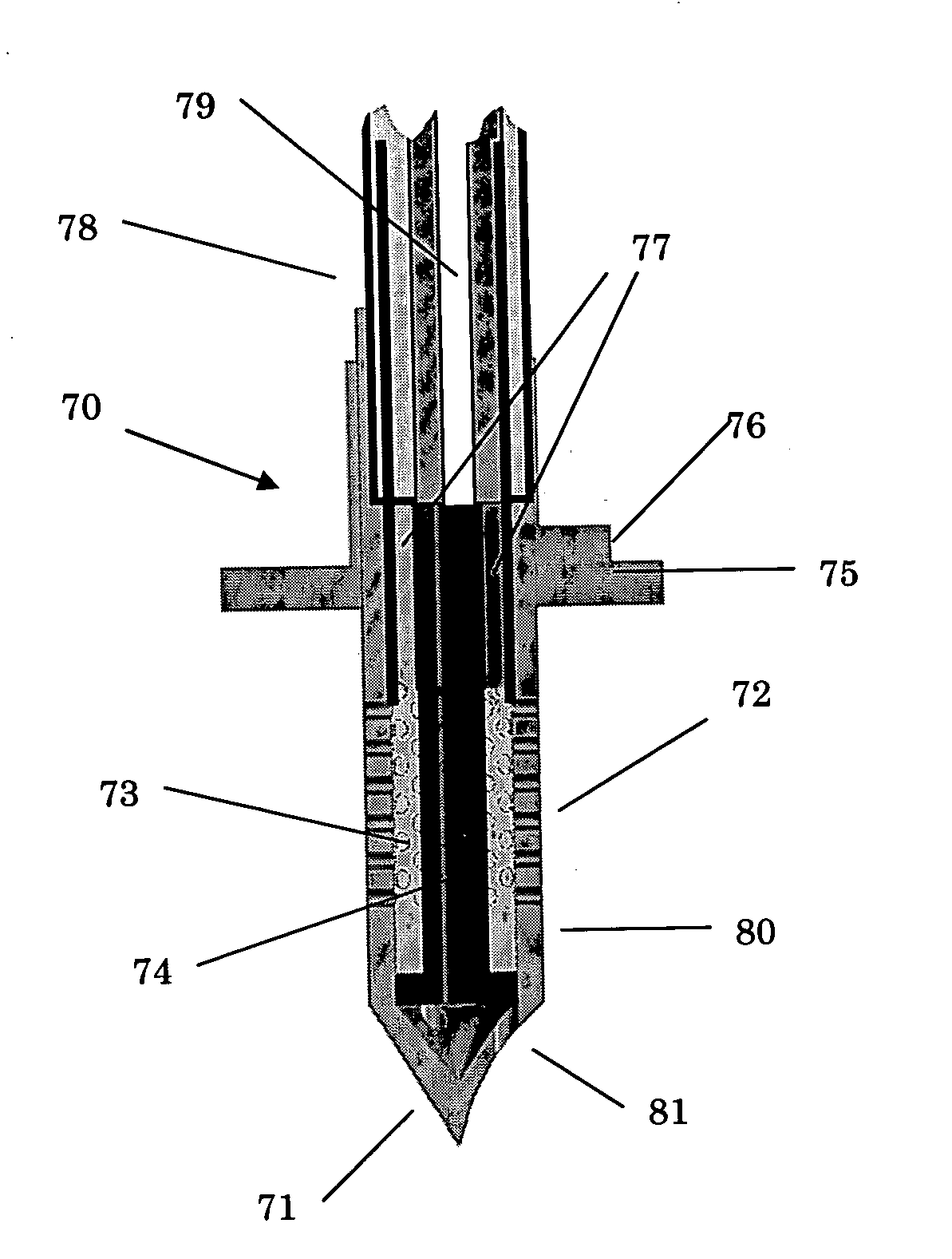 Minimally invasive, sustained, intra-tympanic drug delivery system