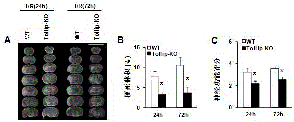 Application of toll-acting protein (tollip) in stroke