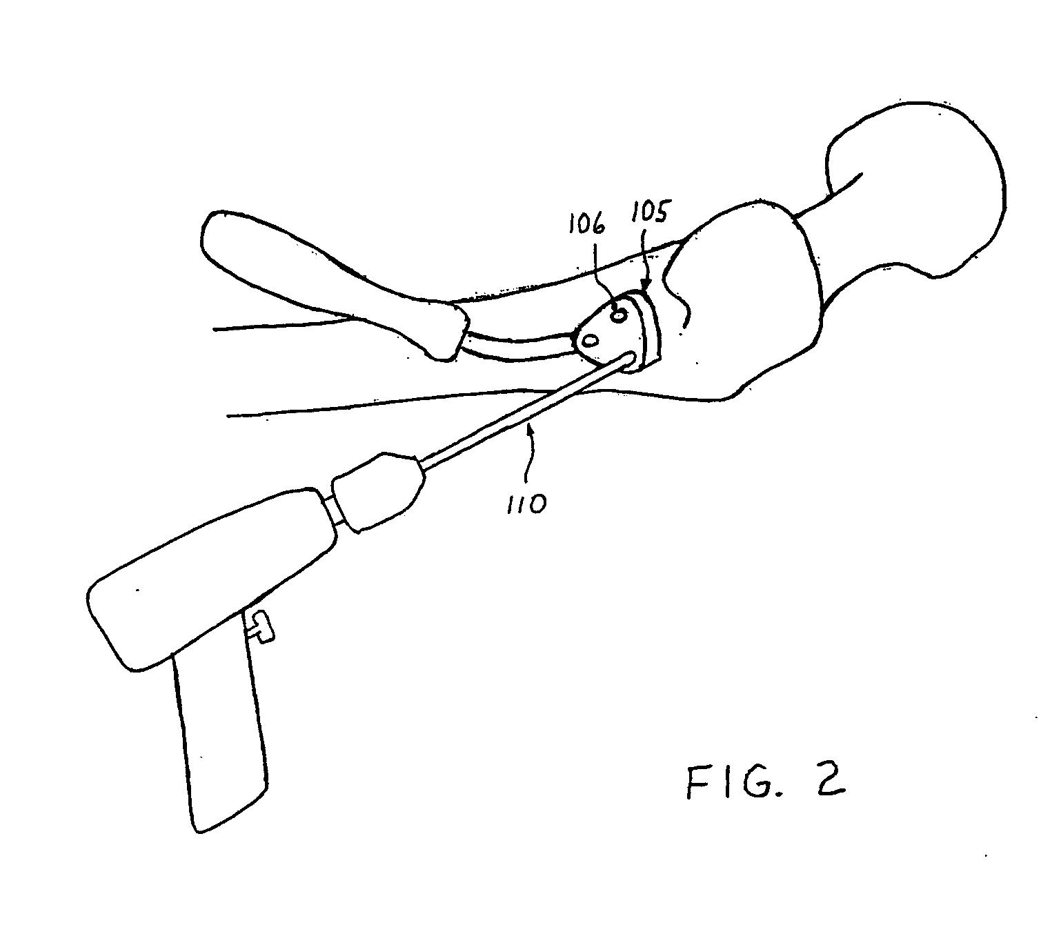 Enhanced graphics features for computer assisted surgery system