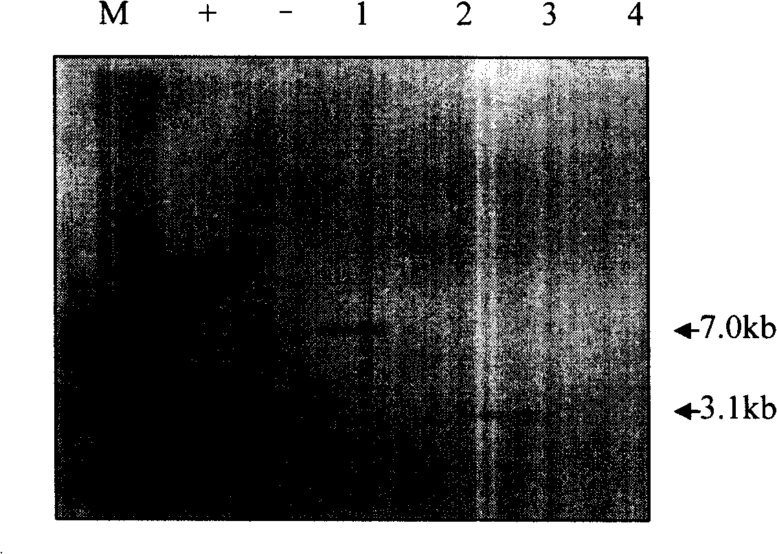 High-efficiency genetic transformation method for soybean immaturity seed lobe regeneration system with auxiliary vacuum permeation