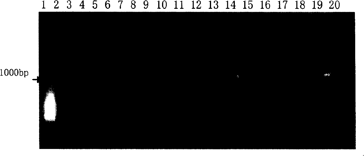 High-efficiency genetic transformation method for soybean immaturity seed lobe regeneration system with auxiliary vacuum permeation