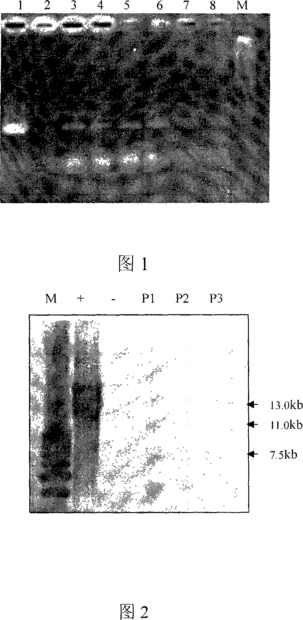 High-efficiency genetic transformation method for soybean immaturity seed lobe regeneration system with auxiliary vacuum permeation