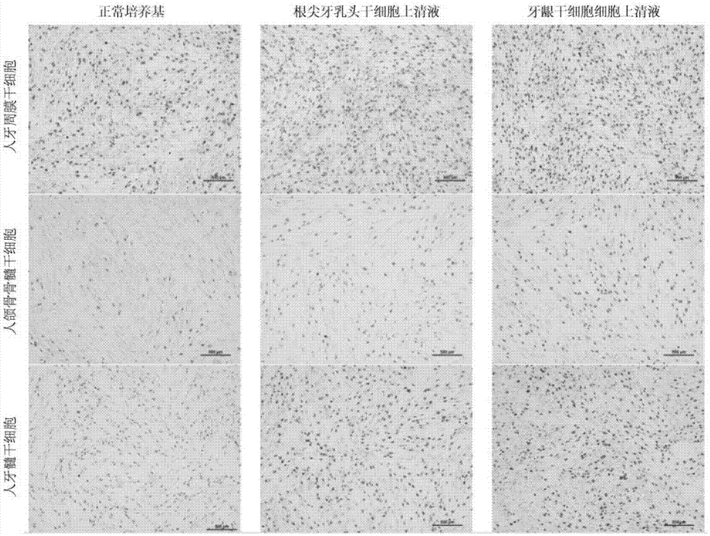 Application of mesenchymal stem cell culture or culture supernatant thereof