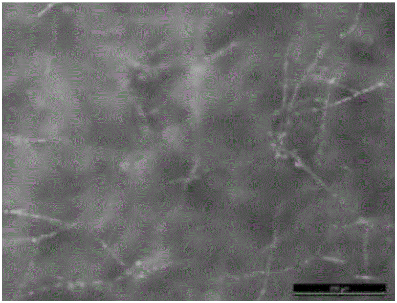 Culture medium for quickly screening filamentous fungi for producing polyunsaturated fatty acid and application of culture medium