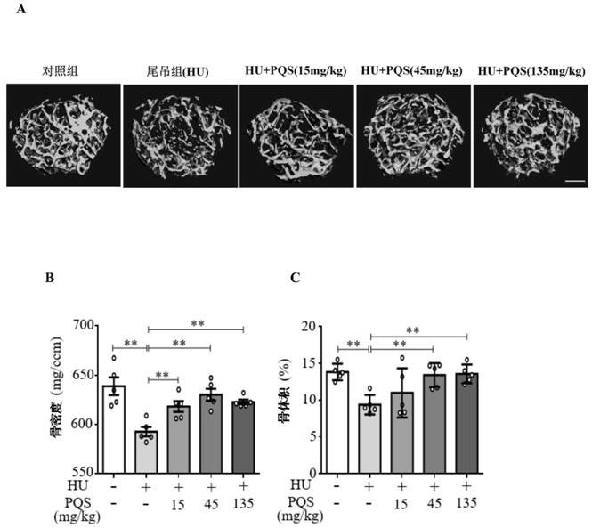 Application of panax quinquefolius stem and leaf total saponins in preparation of composition for resisting bone loss