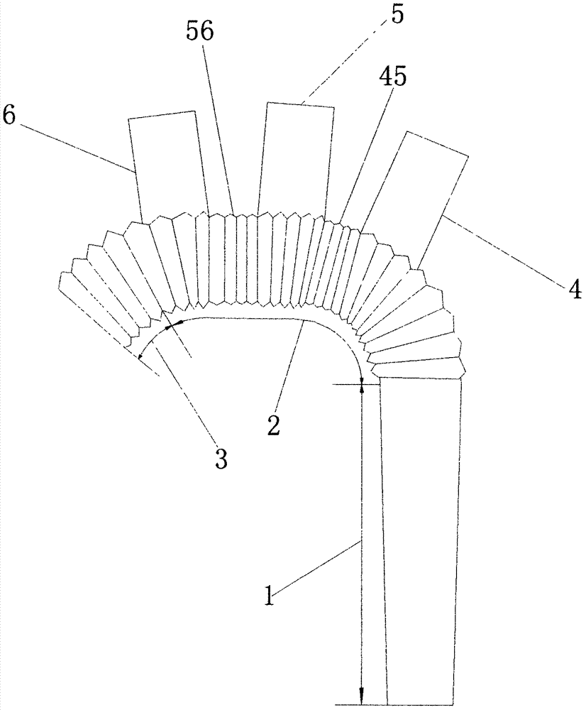 High-compliance three-branch stent used in aorta surgery