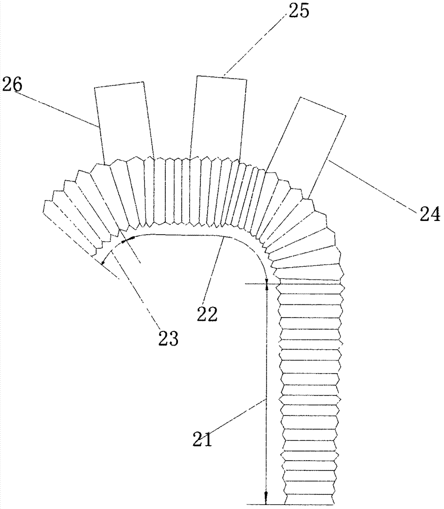 High-compliance three-branch stent used in aorta surgery