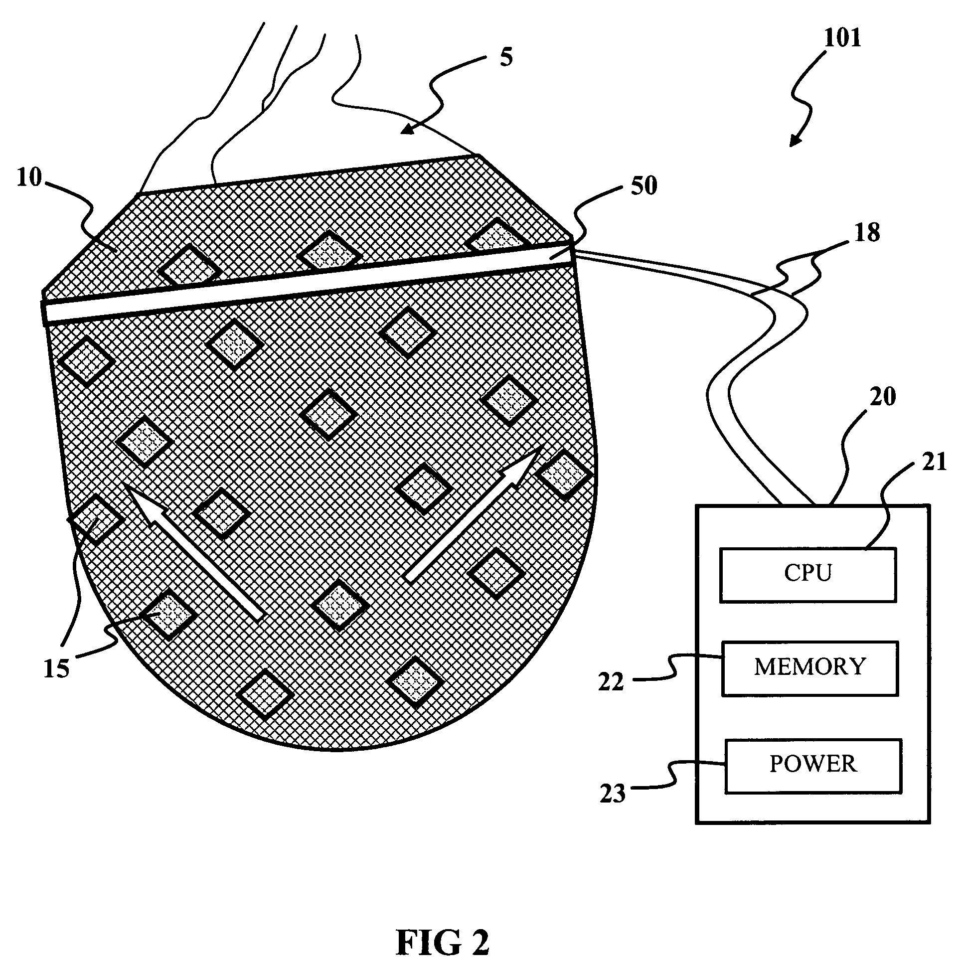 Electromechanical machine-based artificial muscles, bio-valves and related devices