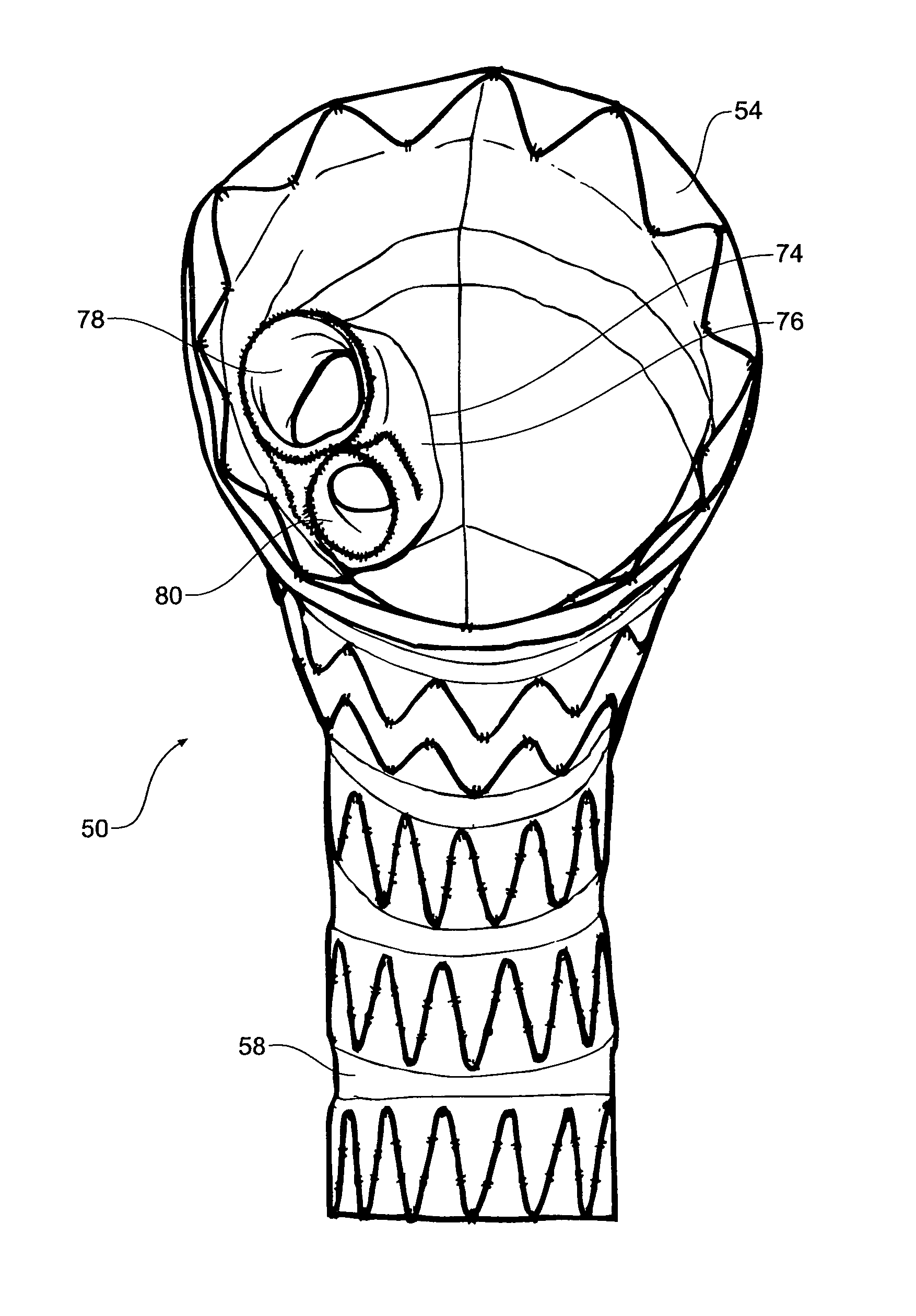 Thoracic aorta stent graft with access region