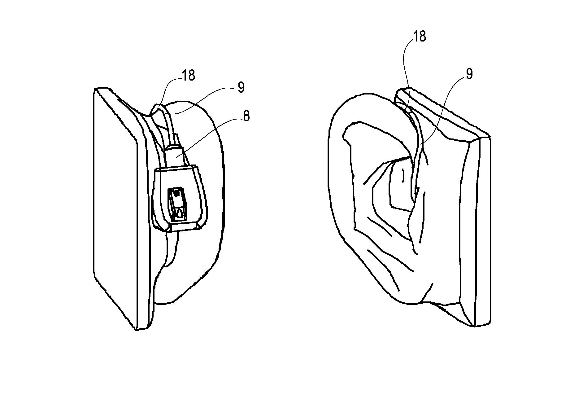 Method of preparing a hearing aid, and a hearing aid