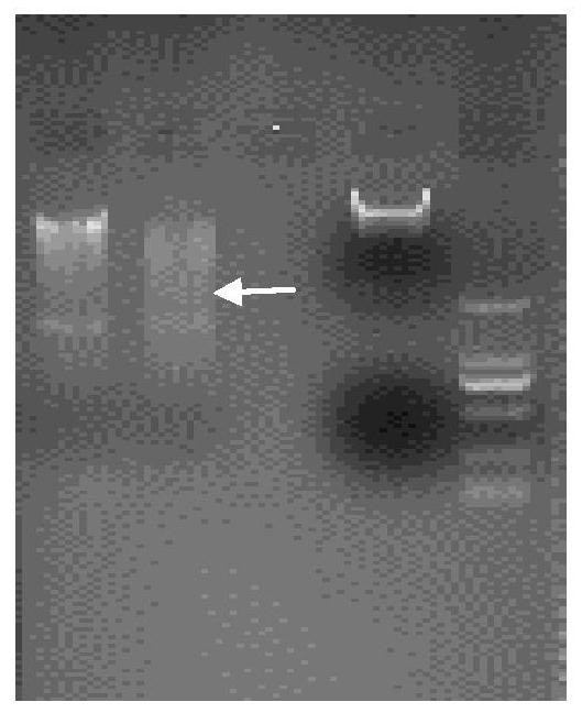 Bifunctional fusion protein combined with coronavirus as well as preparation method and application of bifunctional fusion protein