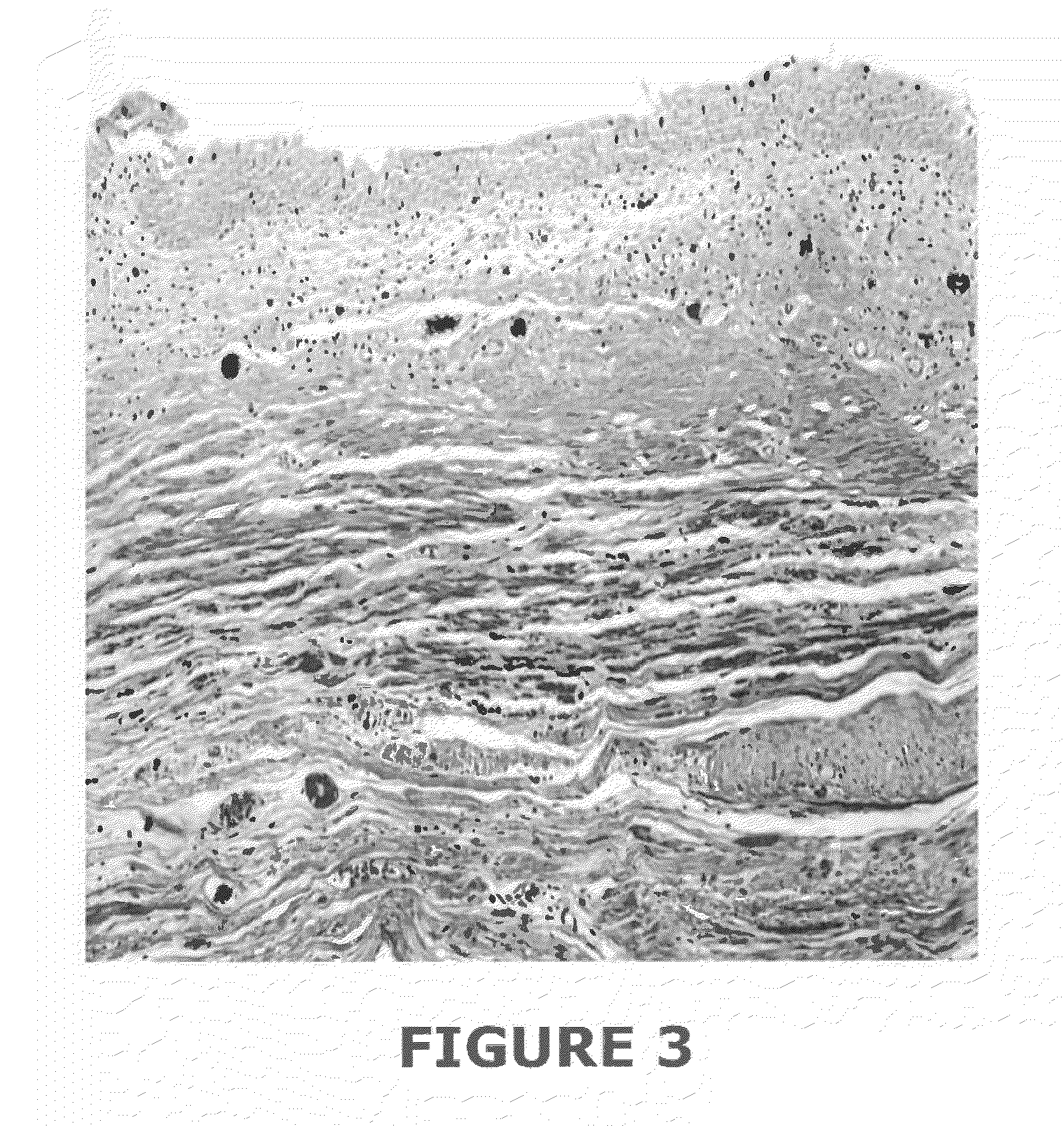 Tissue graft compositions and methods for producing same