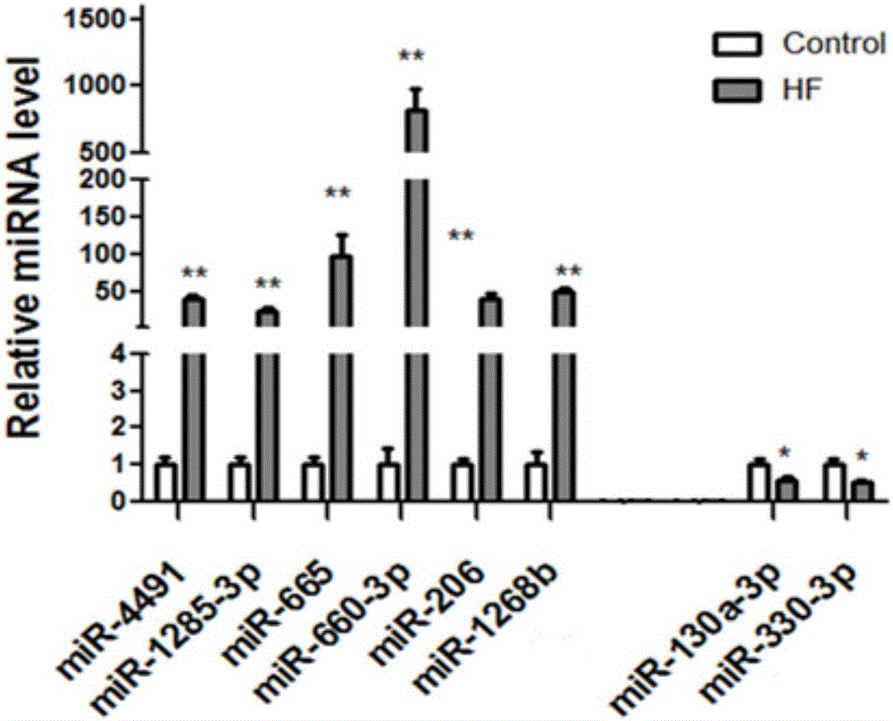 Serum miRNA relevant to chronic heart failure and application of serum miRNA