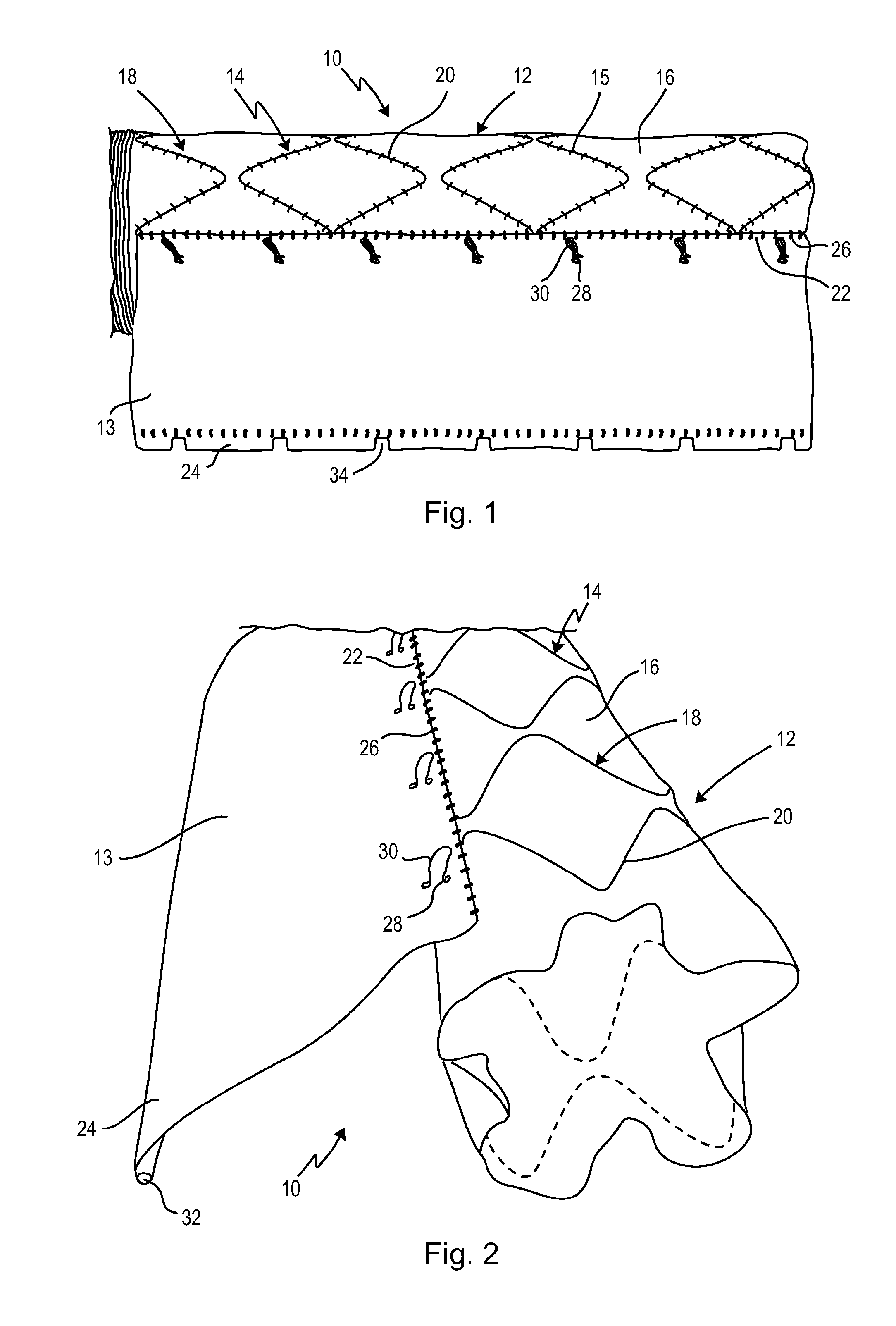 Stent graft