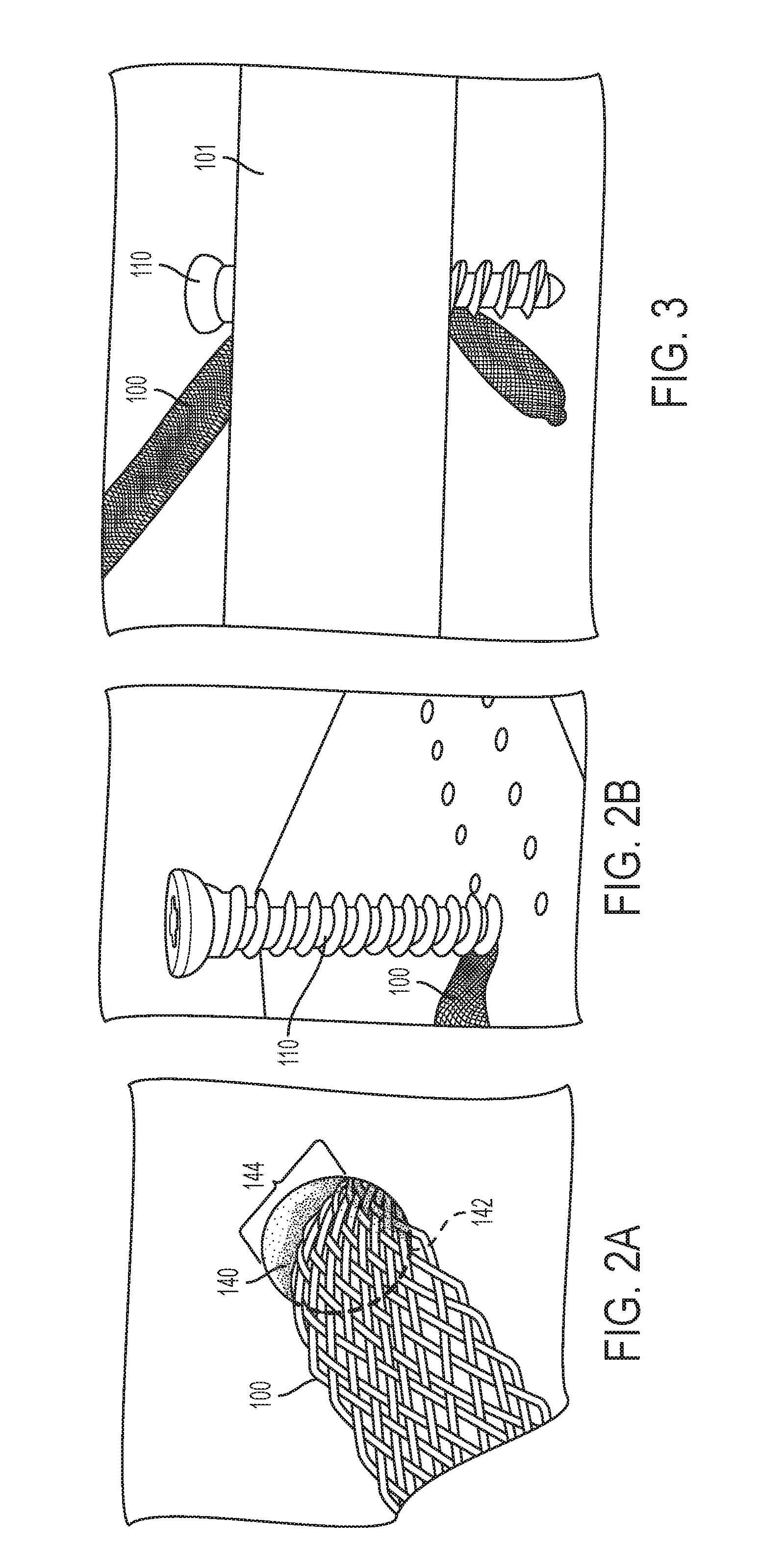 Devices, systems and methods for use in bone tissue