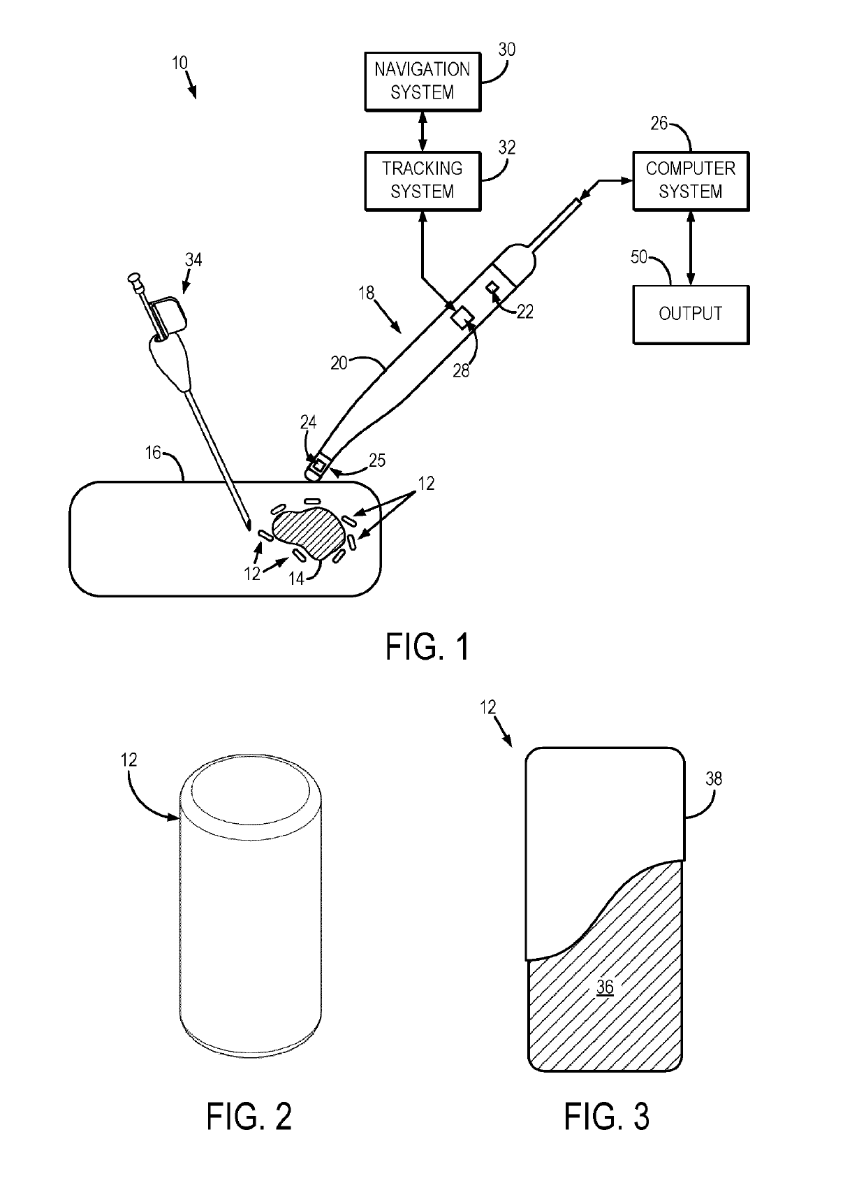 System and method for magnetic occult lesion localization and imaging