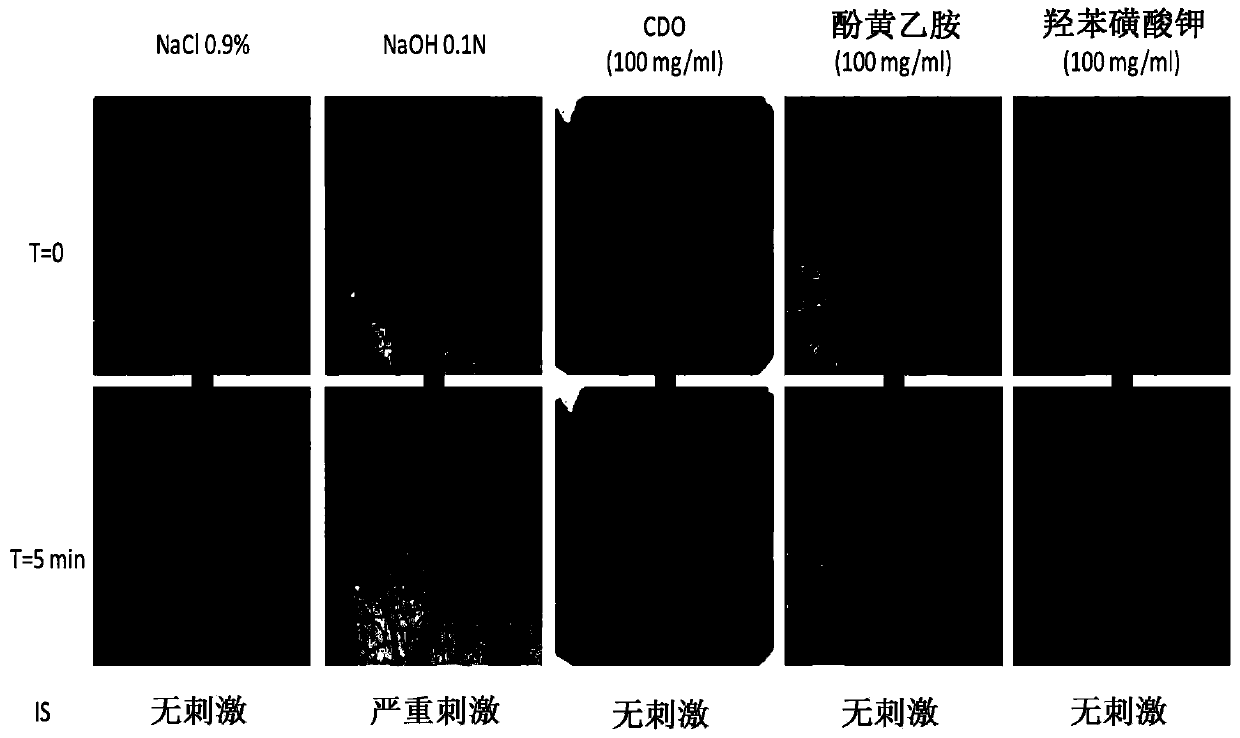 Ophthalmic topical composition comprising dobesilic acid for treating diseases of posterior segment of eye