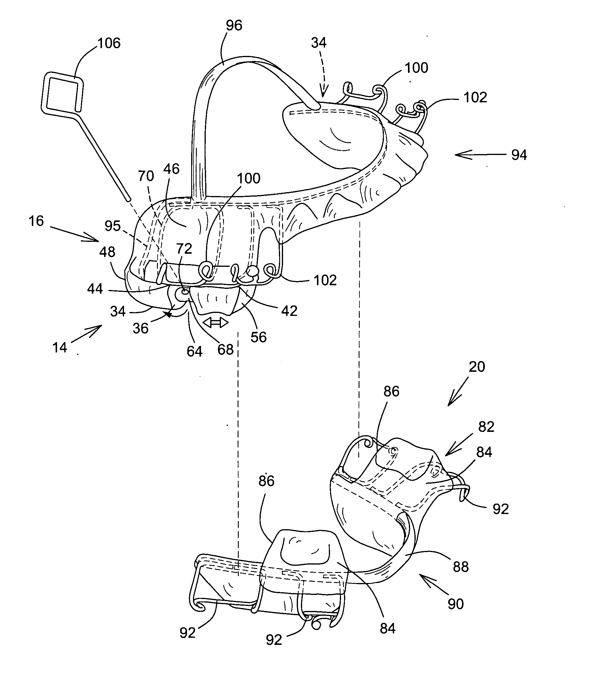 Anti-snoring apparatus