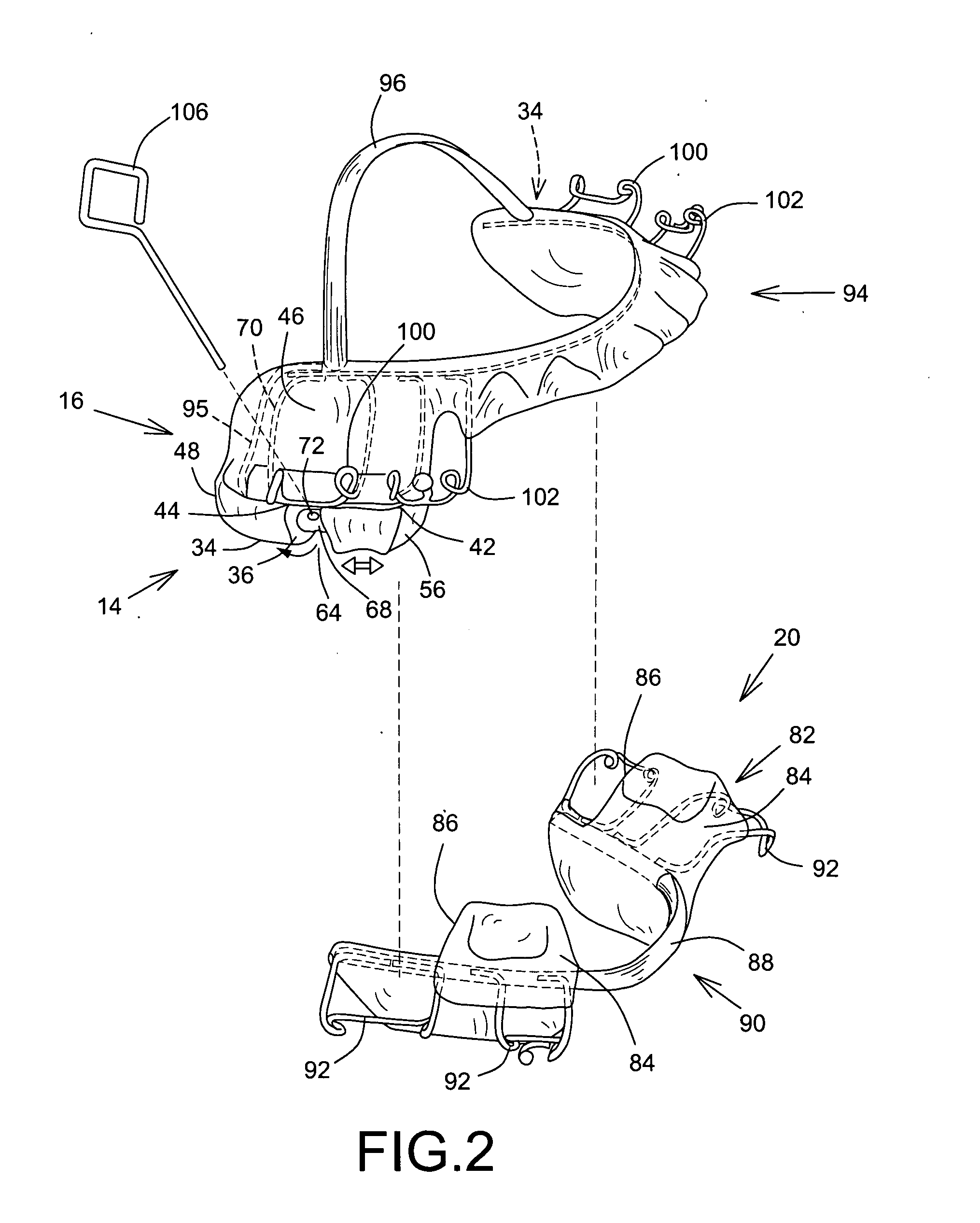 Anti-snoring apparatus