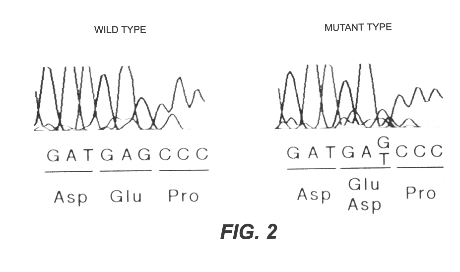 Diagnosis of diseases associated with coronary twitching