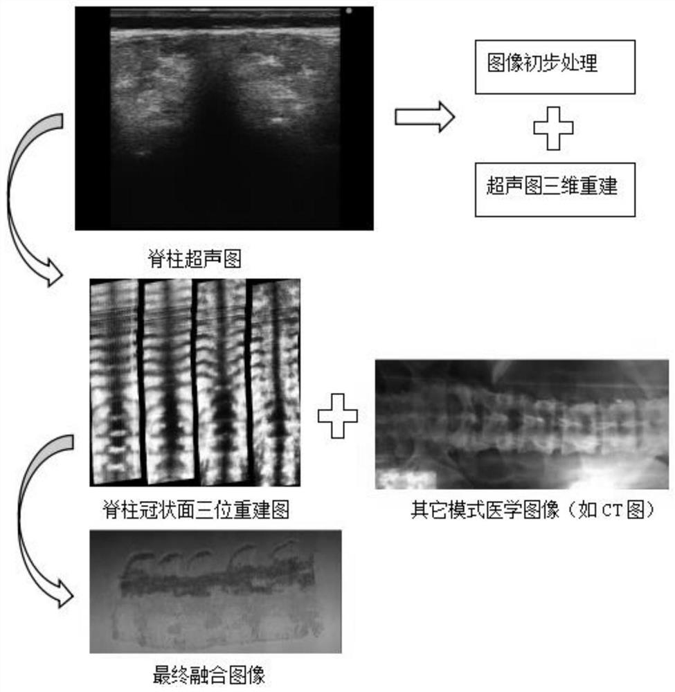 A system and method for intelligent positioning of spinal cord body surface puncture entry points based on multi-modal medical fusion images