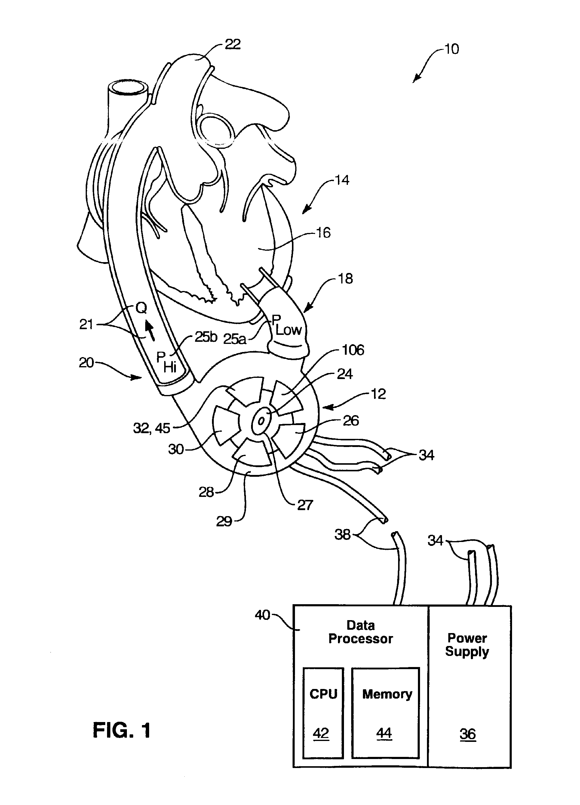 Rotary blood pump diagnostics and cardiac output controller