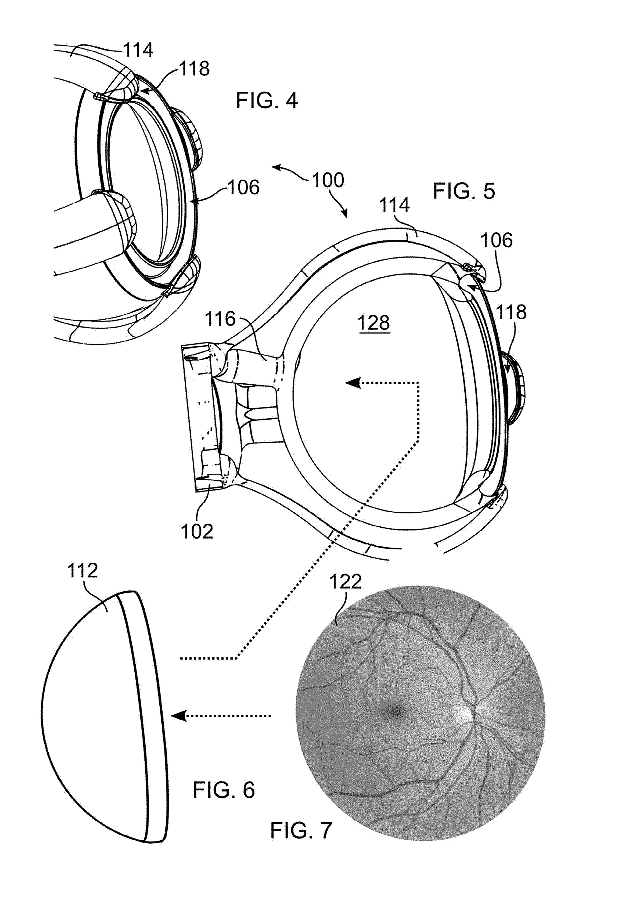 Simulating eye surgery